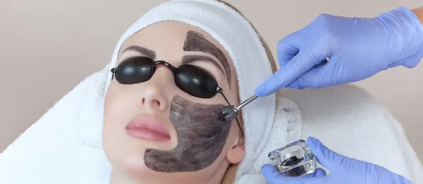 Carbon laser peeling: masker, laser en een stralend resultaat